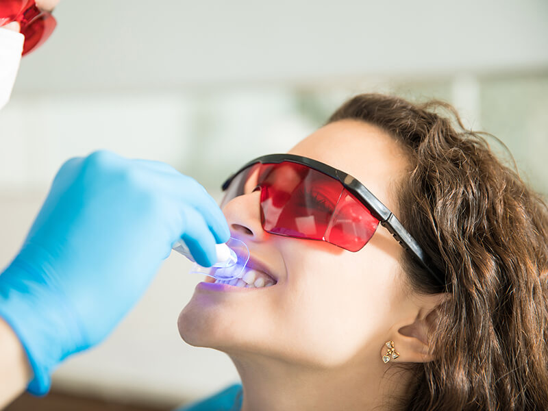 Clareamento dental