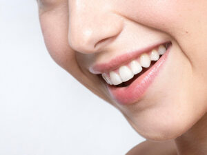 Clareamento dental