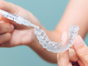 Clareamento dental