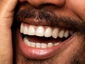 sorriso amarelado