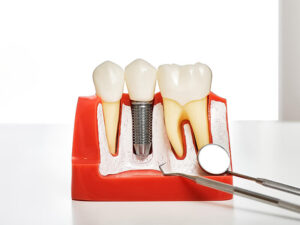 cirurgia oral